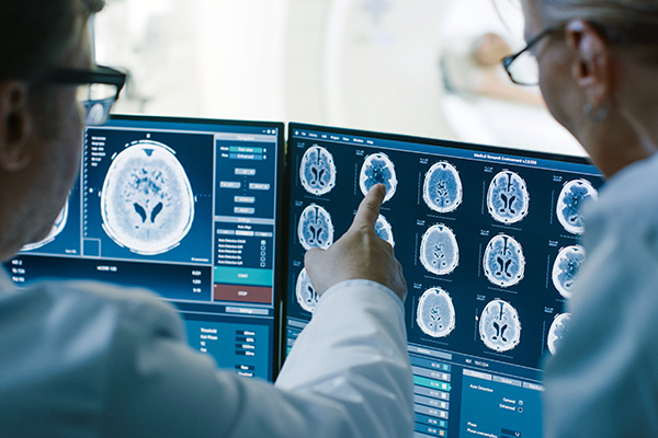 Radiologists review MRI scan of a patient's brain (stock image)