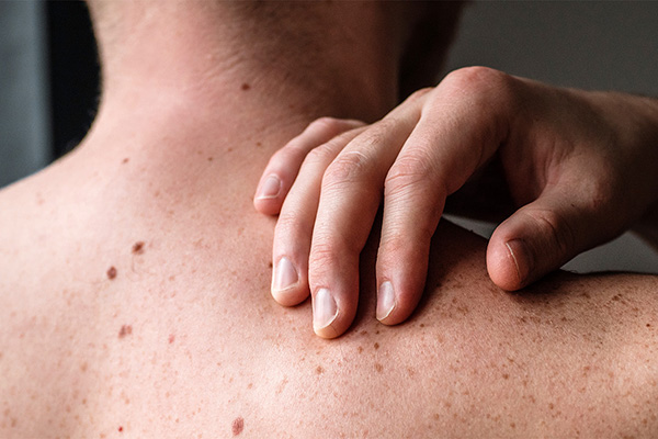 Man reaching over his shoulder to touch his skin with his hand (stock image)