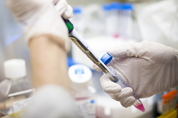 Gloved lab technician's hands holding a pipette