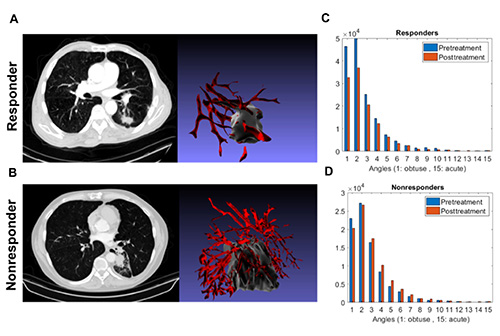 Photo of New AI-based biomarker can help predict immunotherapy response for patients with lung cancer