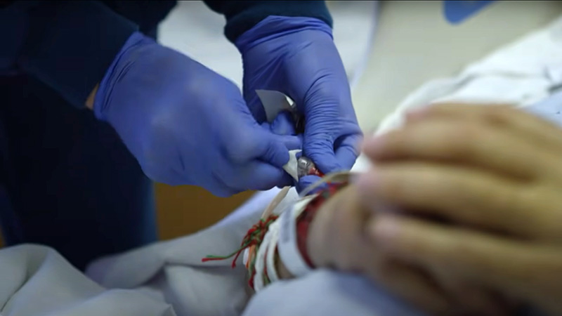 Oncology nurse preparing bone marrow transplant on a patient
