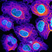 Microscopy image of tubulin and DNA in cancer cells.