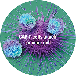 CAR T-cells attack cancer cell.