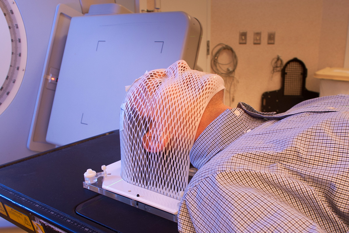 Adult male patient receiving radiotherapy for head and neck cancer (stock image)