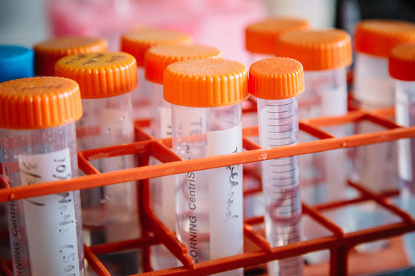 Lab vials sitting in a rack