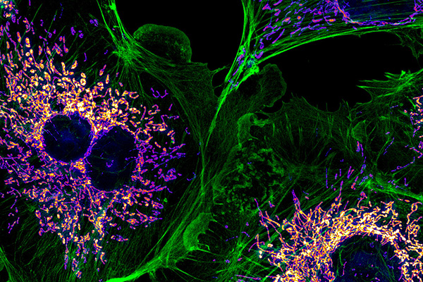 Cellular microscopy image