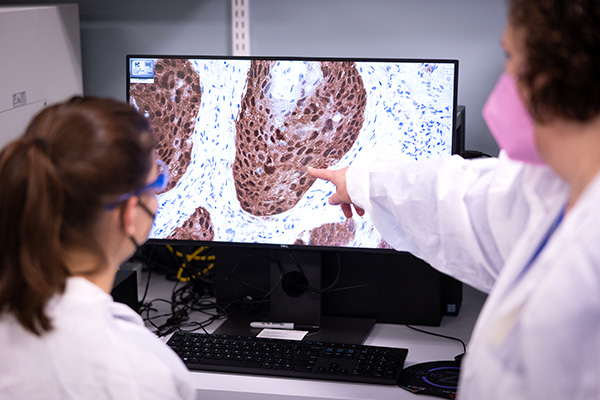 Members of cancer tissue pathology team reviewing a slide on a monitor